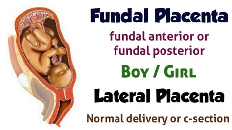 Fundal Placenta and Lateral Placenta in tamil - YouTube