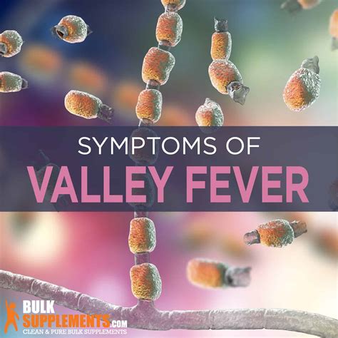 Valley Fever: Symptoms, Causes & Treatment