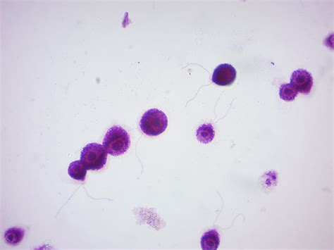 14 Protista | Laboratory Manual For SCI103 Biology I at Roxbury Community College