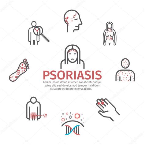 Psoriasis. Síntomas, tratamiento. Juego de iconos de línea. Signos vectoriales para gráficos web ...