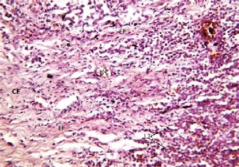 Orcein stain (40x) of lacrimal sac. Blood vessel BV, Collagen fibers... | Download Scientific ...