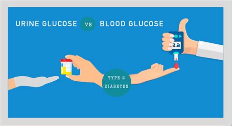 Sugar in Urine - Everything You Need to Know - Sugar.Fit