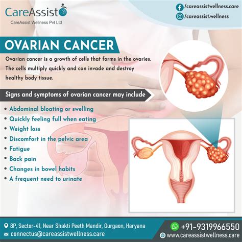 Ovarian Cancer Treatment Cost in India - CareAssist Wellness