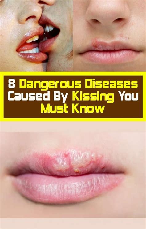 Eight Dangerous Diseases Because You Must Know # ...