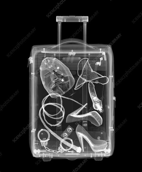 Suitcase, X-ray - Stock Image - F030/9855 - Science Photo Library