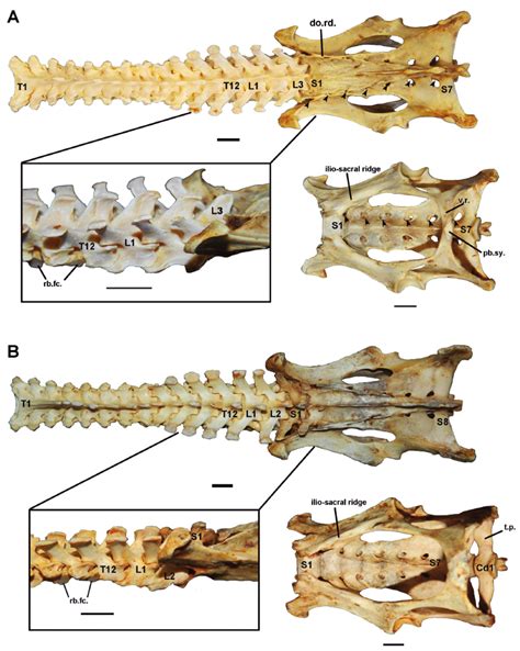 SciELO - Brasil - The vertebral column of Chaetophractus villosus ...