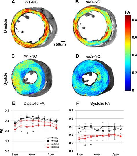 A-D: representative LV fractional anisotropy (FA) maps at base of a WT... | Download Scientific ...