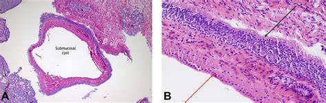 Laryngeal Ventricle Histology