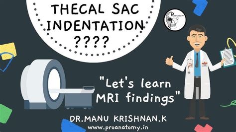 Thecal Sac Mri