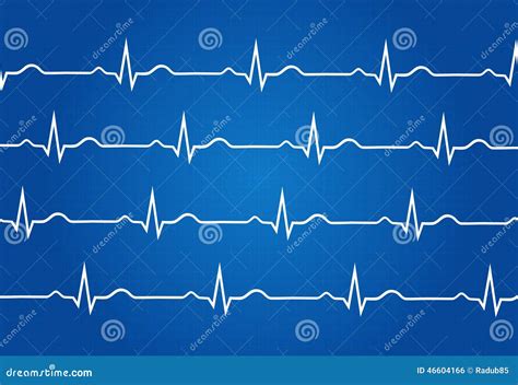 Normal Electrocardiogram Graphic Stock Vector - Illustration of healthy, cardiology: 46604166