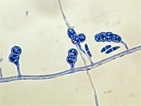 Fusarium | Mycology | University of Adelaide