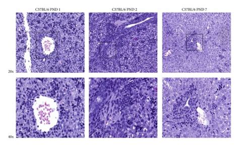 In NOD mice the granulocytic phenotype of cells accumulated around the ...