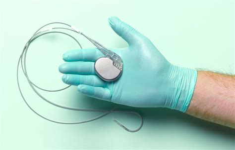 Pacemaker Surgery: Preparation, Recovery, Long-Term Care