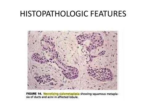 Necrotizing sialometaplasia