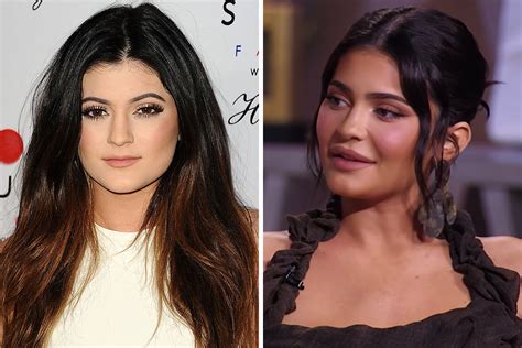 Kylie Jenner, 23, accused of getting 'too much filler' in her face & lips on KUWTK reunion and ...