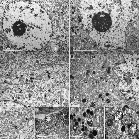 Cell populations and vasculature of supraoptic nucleus at the somatic... | Download Scientific ...