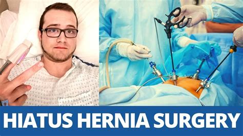 Hiatus Hernia Surgery & 1 Week Post [My Experience] (Part 3/7) - YouTube