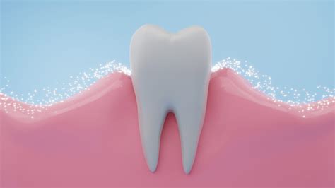 Maintain a Beautiful Smile: Tips for Healthy Bottom Gums Kristal Clinic