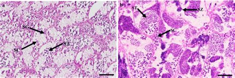 Transverse section of the sterlet testis during winter (pre-spawning... | Download Scientific ...