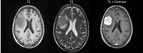 The Basics of MRI Interpretation | Radiology | Geeky Medics