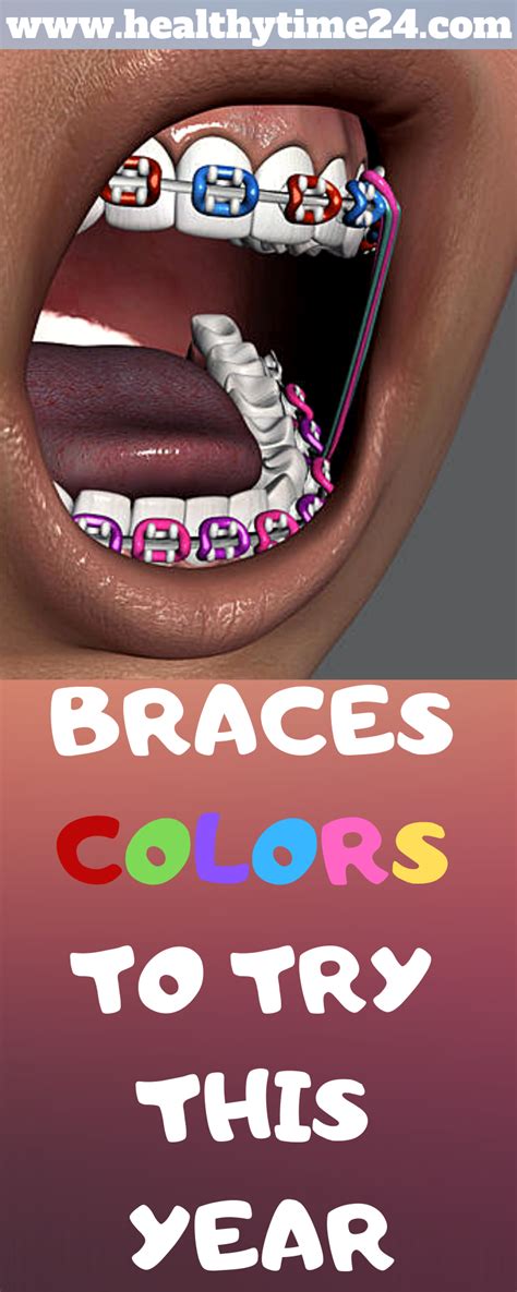 √ Braces Colors Wheel