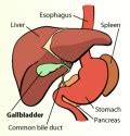 Gallbladder Sludge - Treatment, Symptoms, Removal, Diet, Causes | hubpages