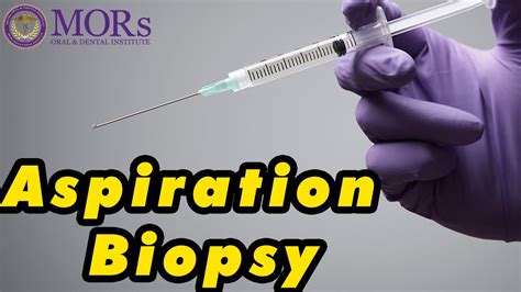 FINE NEEDLE ASPIRATION BIOPSY PROCEDURE - YouTube