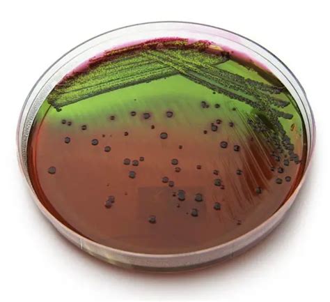 Eosin Methylene Blue (EMB) Agar : Composition, uses and colony characteristics - microbeonline