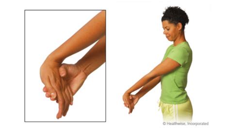 Wrist Flexor Stretch - Exercises For Injuries