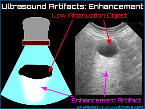 Ultrasound | Oncology Medical Physics