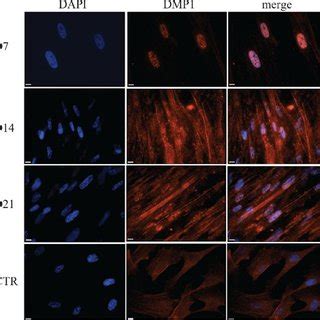 Odontoblastic markers COL1A1 (A), DSPP (B) and DMP1 (C) mRNA expression... | Download Scientific ...