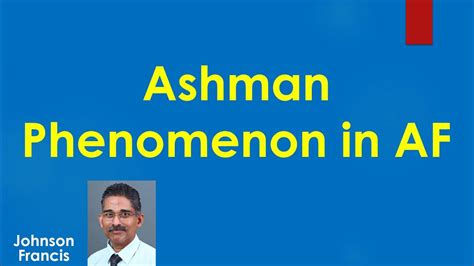 Ashman Phenomenon in AF - YouTube