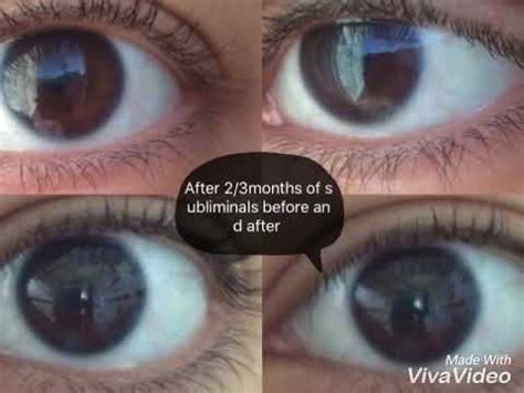 Before and after biokinesis eye color change - YouTube