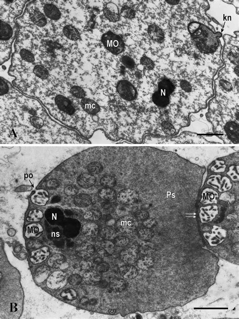 Steinernema feltiae spermatozoa, TEM. A: Immature spermatozoa in ...