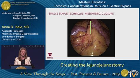 Creating the Jejunojejunostomy - YouTube