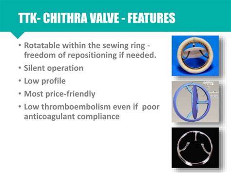 Prosthetic heart valves types physiology