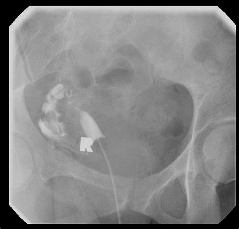 COW-Article – Department of Radiology – UW–Madison