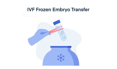 IVF Frozen Embryo Transfer - Timeline, Process, Pregnancy Test