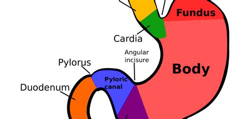 The Gastric Fundus and Lap Band Removal - Houston Weight Loss Surgery Center