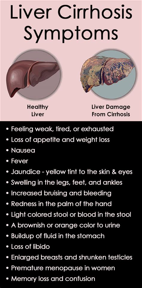 Liver Cirrhosis Symptoms, Causes and Treatments - SummitRehab