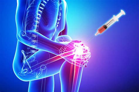 PRP VS Stem Cell Therapy