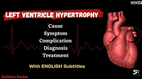 LVH - Left Ventricular Hypertrophy | Cause Symptoms Treatment | Hindi | Sedative Doctor - YouTube