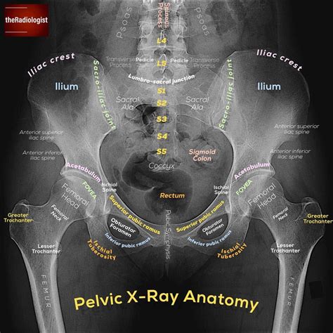 👨🏽‍💻Want to learn a system for reviewing a pelvic X-ray? Read on to find out and swipe left to ...