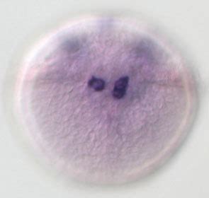 Polychaete ParaHox genes – EDGe