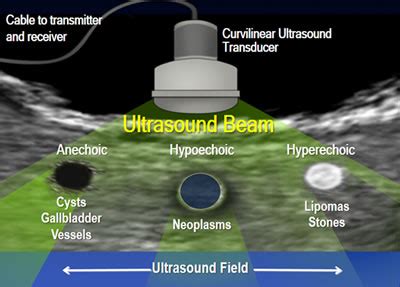 Understanding Endoscopic Ultrasound - Educational Dimensions