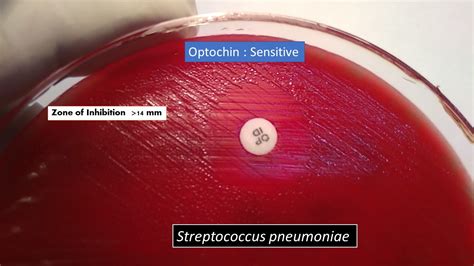 Optochin Susceptibility test :Principle, procedure, result and interpretation