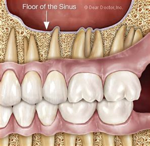 Tooth Pain - Likely causes and what can be done