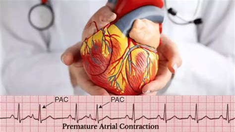 Difference Between PAC and Sinus Arrhythmia – Difference Between