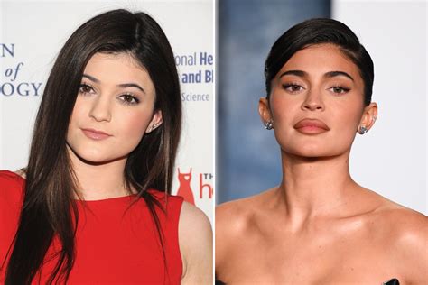 Kylie Jenner's Plastic Surgery Comments Spark Jokes, Memes - Newsweek