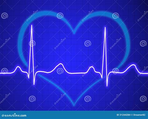 Electrocardiogram, Ecg, Graph, Pulse Tracing Stock Illustration - Illustration of abstract ...